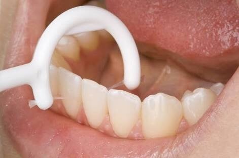 Diş arasına kaçan artıklar en sağlıklı nasıl temizlenir? Diş ipi ile sıkışan et parçalarından kurtulmak 4